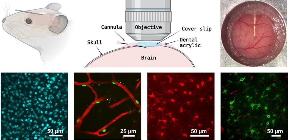 Imagen: el sistema de cánula administra agentes de imágenes directamente al cerebro sin obstruir la trayectoria óptica para obtener imágenes de tejido profundo de alta resolución (foto cortesía del S. S. Hou/Massachusetts General Hospital) Imagen: el sistema de cánula administra agentes de imágenes directamente al cerebro sin obstruir la trayectoria óptica para obtener imágenes de tejido profundo de alta resolución (foto cortesía del S. S. Hou/Massachusetts General Hospital)